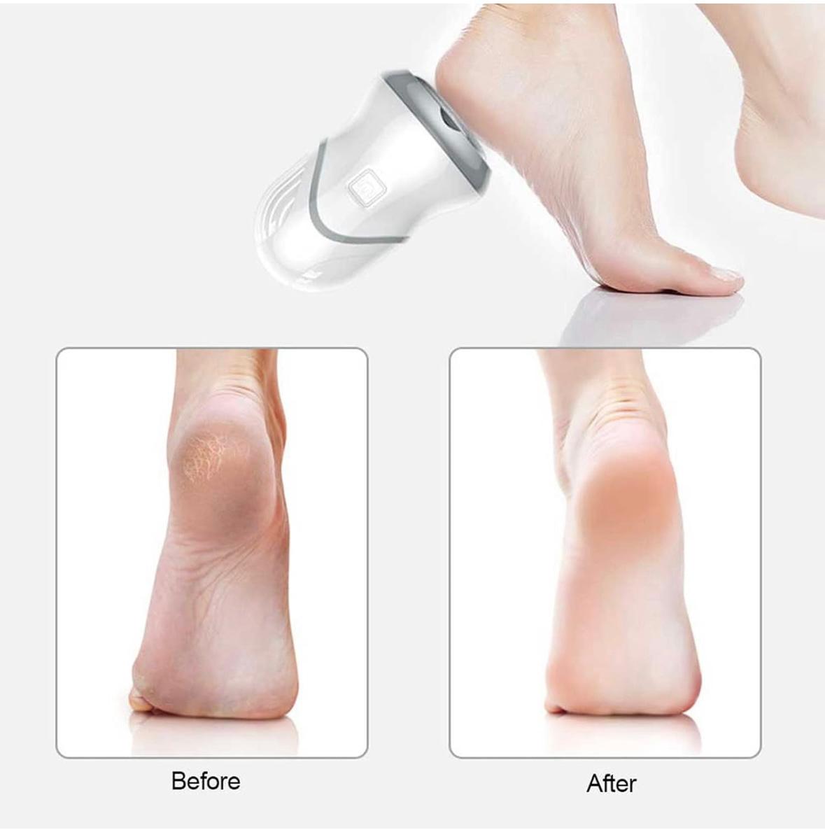 Meuleuse De Pied Électrique,